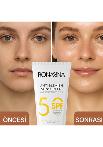 Güneş Kremi - Leke Giderici, Yüksek Korumalı 50 Spf, Aydınlatıcı, Tüm Cilt Tipleri Için - 50ml indirimleri