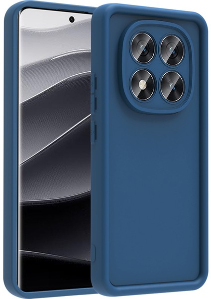 Xiaomi Poco X7 Uyumlu Kılıf Kamera Korumalı Zore Ananas Kapak