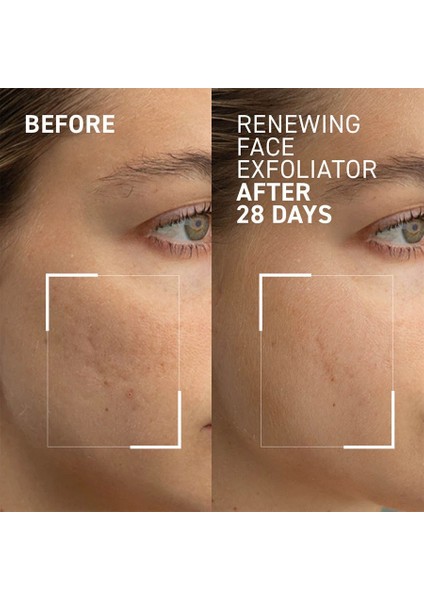 Microdermabrasion Exfoliatıng Face Cream Cilt Bakım Kremi 60 ml modelleri