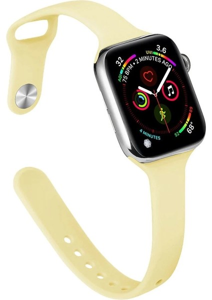 Apple Watch 42MM Klasik Kordon - Sarı - NEONX2678-4659