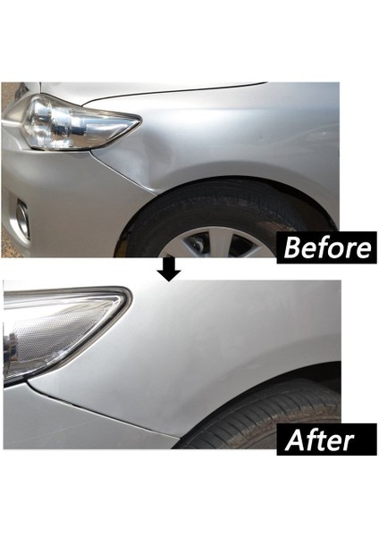 Köprü Dent Çektirme Setleri Paintless Göçük Kaldırma Onarım Aracı ile 6 Adet Tutkal Çektirme Sekmeler Için Otomatik Göçük Kaldırma Küçük Ezik Kapı Dings ve Dolu Hasar (Yurt Dışından)