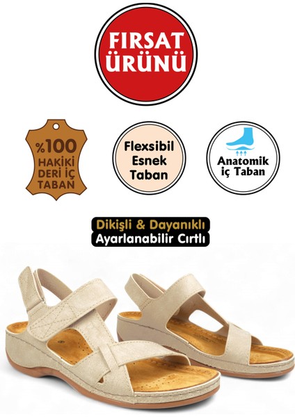 Bej Renk Cırtlı Kadın Sandalet (Fırsat Ürünü-Sınırlı Stok)