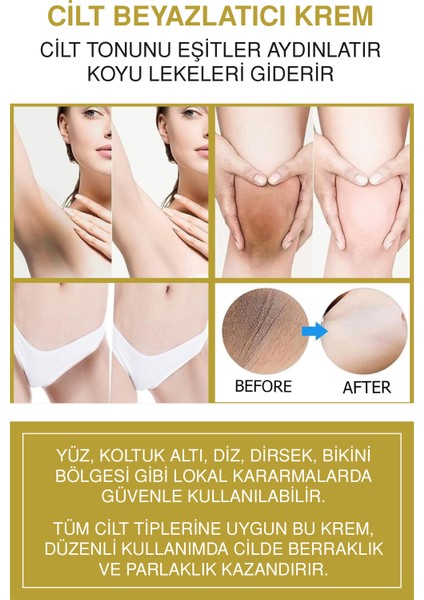 Cilt Lekelerine Veda Seti | Kolajenli Serum 30ML + Beyazlatıcı Krem 50ML fiyatları