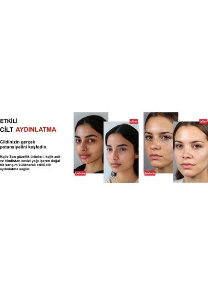 Kojie San Kojik Asit Sabunu 3X65GR modelleri