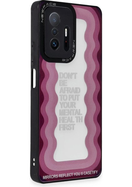 Xiaomi Mi 11T Pro Kılıf Mirror Desenli Kapak - Mirror - 11 Arbkd