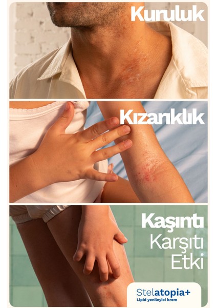 Stelatopia Lipit Yenileyici Krem Pompalı Şişe 300 ml 2 Adet fırsatları