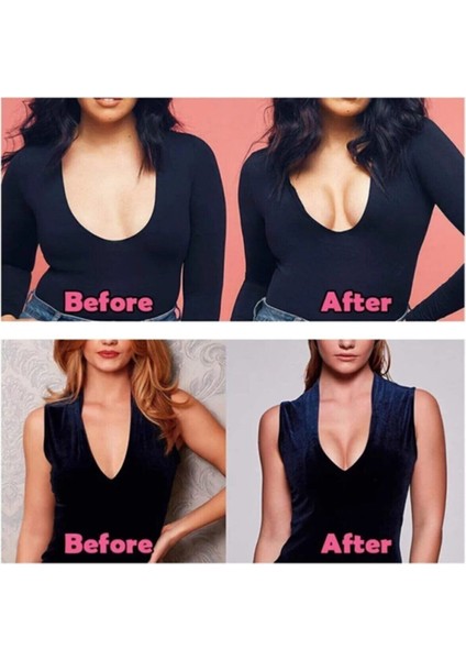 Şekillendirici ve Dikleştirici Bant, Siyah, Konforlu ve Estetik Destek indirimleri