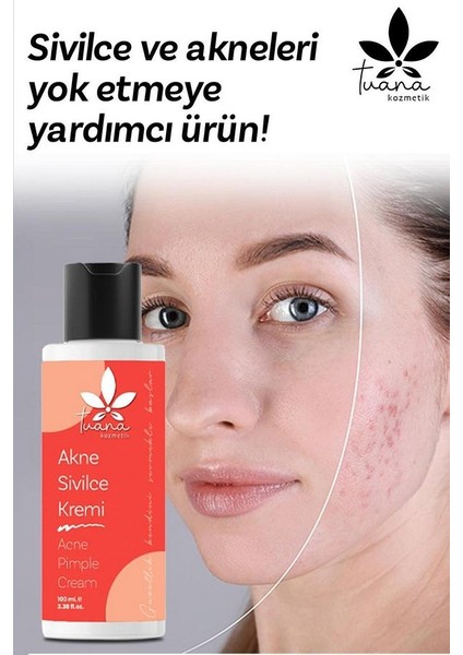 Akne S.ivilce ve Çil Leke Cilt Kremi 100 ml modelleri
