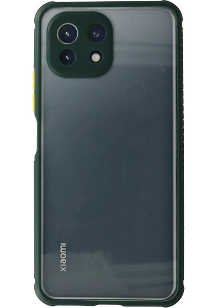 Xiaomi Mi 11 Lite Kılıf Miami Şeffaf Silikon - Koyu Yeşil Arbkd