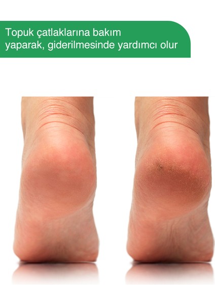Ayak Kokusu Giderici Çay Ağacı ve Doğal Özlü Köpüklü Ayak Bakım Şampuanı 100ML modelleri