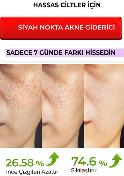 Sérum Réducteur De Pores 30 ml