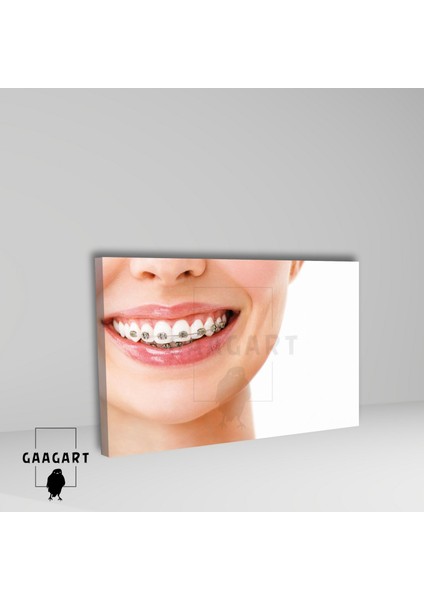 Tekli Yatay Kanvas Diş Poliklinik Tablosu Diş Teli fiyatları