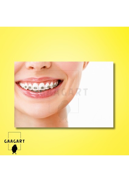 Tekli Yatay Kanvas Diş Poliklinik Tablosu Diş Teli modelleri