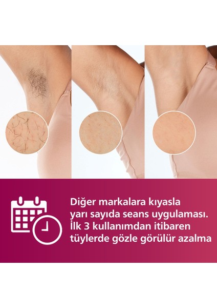 Lumea SC1997 Lazer Epilasyon IPL Tüy Alma Cihazı+ Yüz Tüy Alma Makinesi BRR454/00,Yüz+Vücut+Hassas Bölge Kullanımı fırsatları