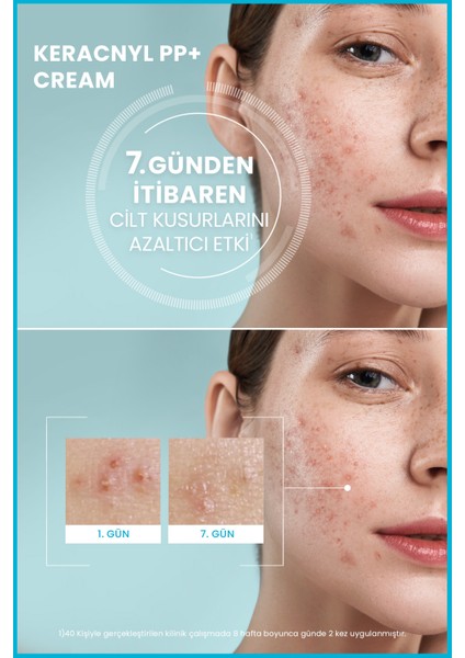 Yağlı & Akneye Eğilimli Ciltler Bakım Kremi 30ML & Keracnyl Uv Fluid Spf 50+ 50ML fırsatları
