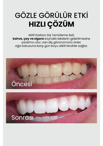 Aktif Karbon Diş Temizleme Macunu 75 ml - Bambu Diş Fırçası Set