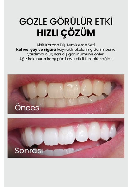 Diş Beyazlatma Seti (Diş macunu 75ml + Toz 50gr fırsatları