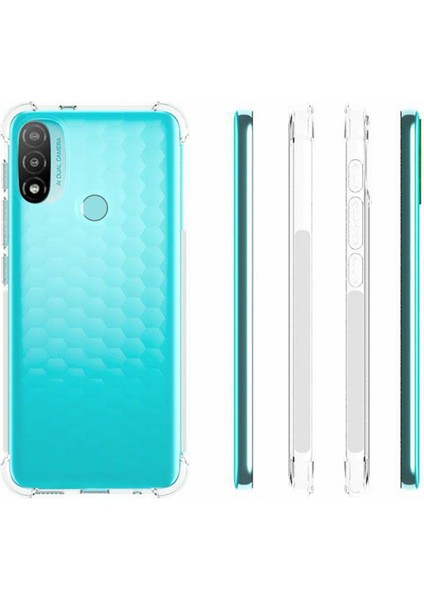 Motorola Moto E20/E30/E40 Için Kristal Netliğinde Esnek Tpu Kaymaz Tutuşlu Darbeye Dayanıklı Çizilmez Koruyucu Kılıf (Yurt Dışından) indirimleri