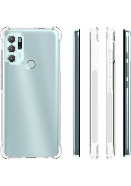 Motorola Moto G60S Akıllı Telefon Kılıfı Tpu Kaymaz Tutacak Darbeye Dayanıklı Çizilmez Koruyucu Kılıf (Yurt Dışından) indirimleri