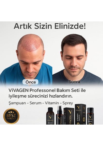 Şampuan fırsatları