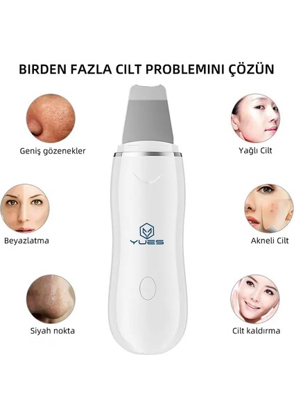 Ultrasonik Spatula Yüz Temizleme Cihazı Siyah Nokta Temizleme Peeling Aleti fiyatları