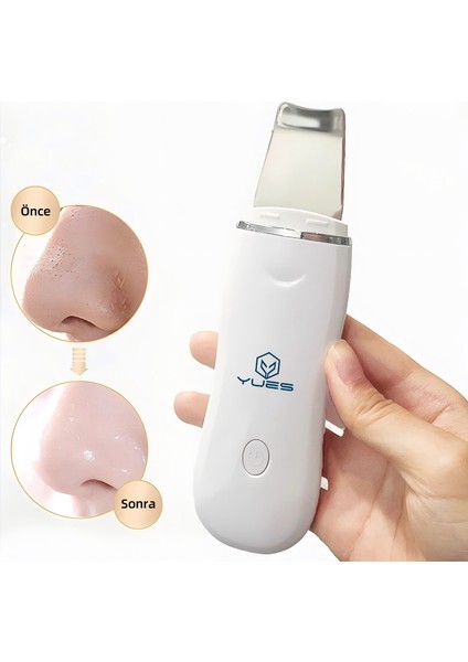 Ultrasonik Spatula Yüz Temizleme Cihazı Siyah Nokta Temizleme Peeling Aleti