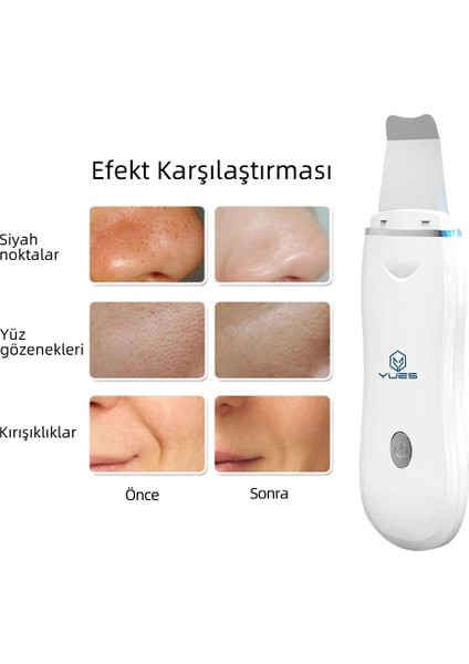 Ultrasonik Spatula Yüz Temizleme Cihazı Siyah Nokta Temizleme Peeling Aleti