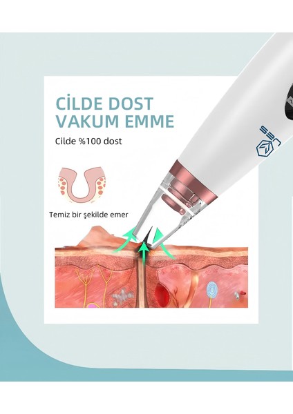 Vakumlu Siyah Nokta Temizleme Cihazı – 3 Mod, Şarjlı, 6 Başlık fırsatları