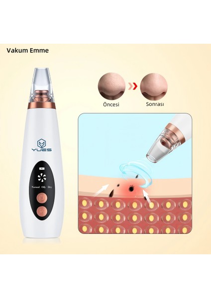 Vakumlu Siyah Nokta Temizleme Cihazı – 3 Mod, Şarjlı, 6 Başlık