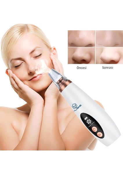 Vakumlu Siyah Nokta Temizleme Cihazı – 3 Mod, Şarjlı, 6 Başlık