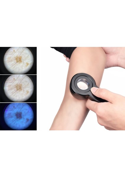 El Tipi Dermatoskop Cihazı Wood (Uv) Modlu modelleri