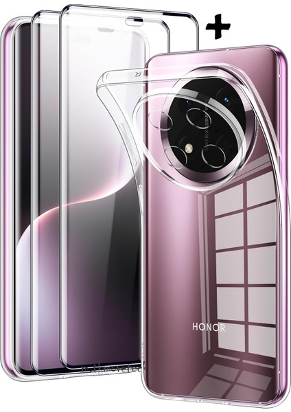 Honor Magic 7 Lite Kılıf Kamera Çıkıntılı Korumalı Yumuşak Şeffaf Silikon + Ekran Koruyucu Cam Set