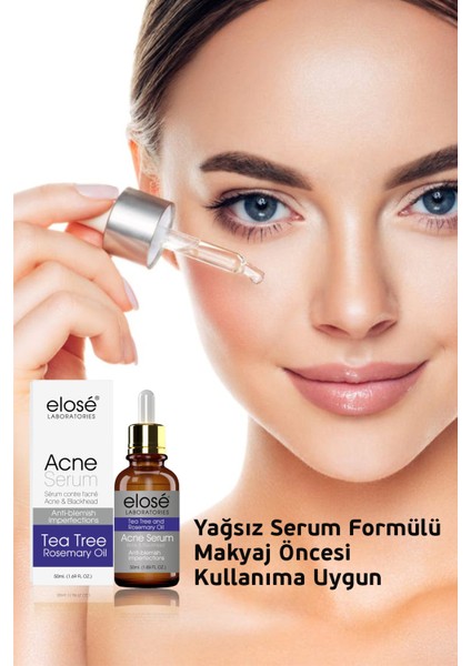 Rosemary Oil Çay Ağacı Yağı Akne ve Siyah Nokta Cilt Bakım Serumu 50ML. fırsatları