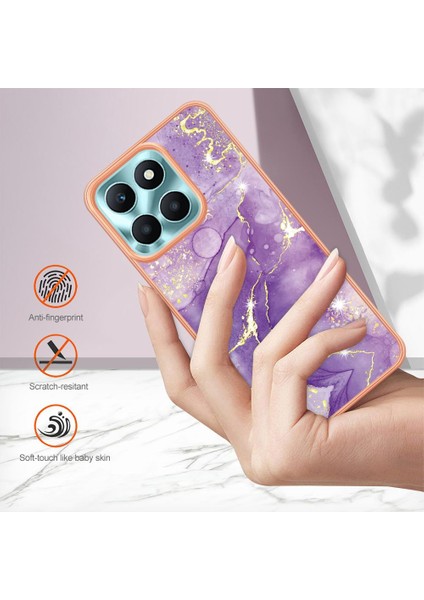 Onur X6A Için Durum (Yurt Dışından) indirimleri