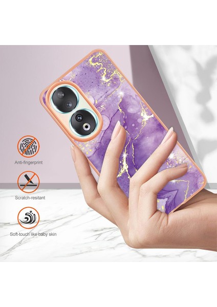 Onur Için Dava 90 5g (Yurt Dışından) modelleri