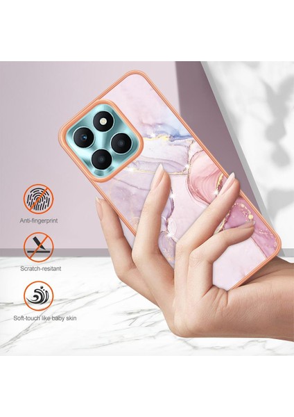 Onur X6A Için Durum (Yurt Dışından) indirimleri