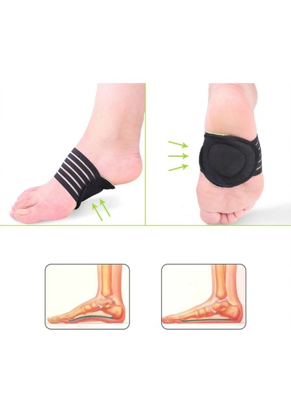 1 Çift Ayak Altı Boşluk Desteği Pedi fiyatları