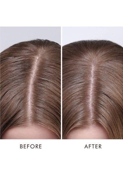 Oil-No-More Scalp Treatment 45Ml modelleri