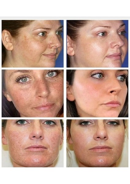 Kanza Cilt Beyazlatıcı Leke Giderici Sabun modelleri