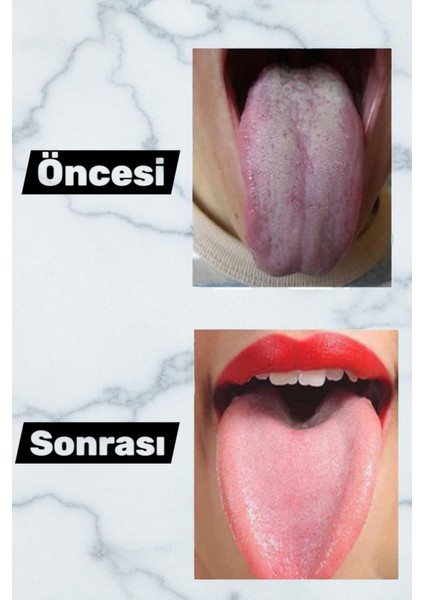 Çelik Dil Temizleyici Dil Sıyırıcı Paslanmaz Çelik Ağız Bakım Fırçası Dil Plak Temizleme Aparatı modelleri