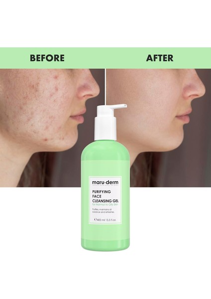 Maruderm Karma ve Yağlı Ciltlere Özel Yüz Yıkama Jeli 400ML fiyatları