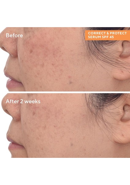 Spf 45 Güneş Koruyucu Leke Karşıtı Serum modelleri