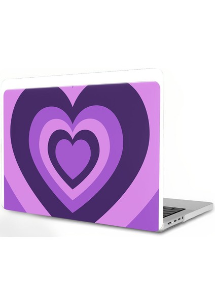 MacBook Air 11 Inç Kılıf ile Uyumlu (Modeller: A1370 ve A1465), Plastik Desenli Sert Kılıf (Yurt Dışından)