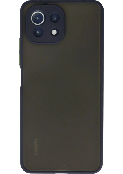 Xiaomi Mi 11 Lite Kılıf Montreal Silikon Kapak - Lacivert