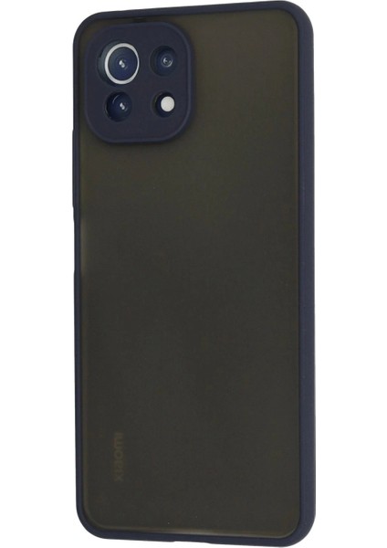 Xiaomi Mi 11 Lite Kılıf Montreal Silikon Kapak - Lacivert modelleri