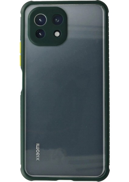 Xiaomi Mi 11 Lite Kılıf Miami Şeffaf Silikon - Koyu Yeşil