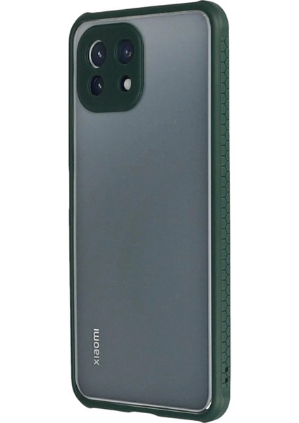 Xiaomi Mi 11 Lite Kılıf Miami Şeffaf Silikon - Koyu Yeşil modelleri