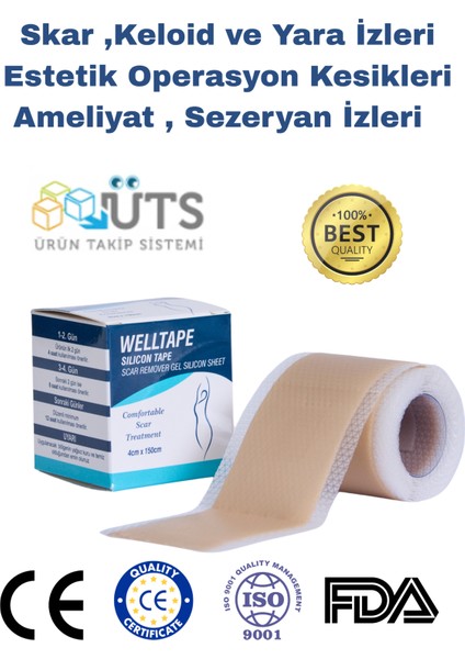 Soft Silikon Bant - Ameliyat Izi Giderici - Sezaryen - Yanık - Estetik 4cm x 1,5mt