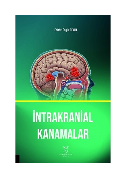 Intrakranial Kanamalar