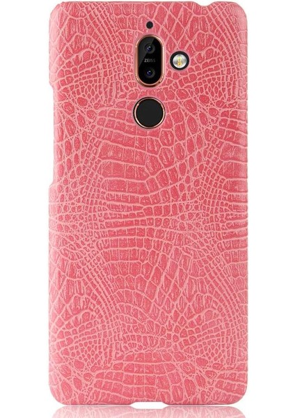 Nokia 7 Plus Anti Scratch Klasik Timsah Kapağı Için Şık Klasik Kılıf (Yurt Dışından) modelleri